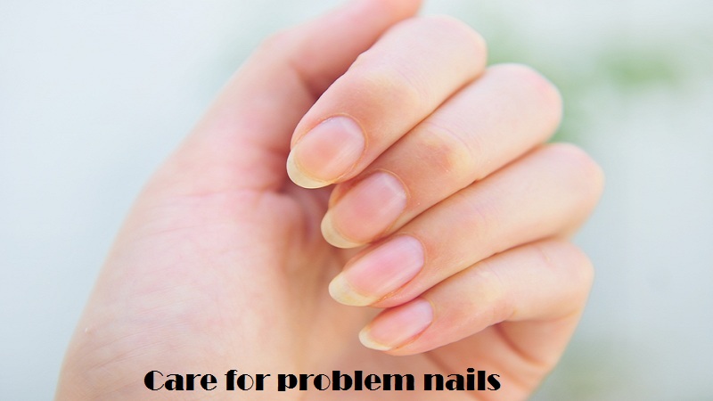 Care for problem nails