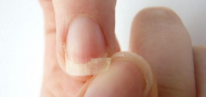 How to strengthen nails